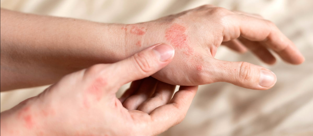 Treating Bacterial Infections: The Role of Generic Ciprofloxacin