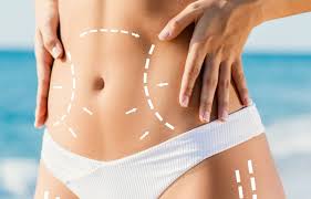 Common Areas Targeted in Body Contouring Treatments